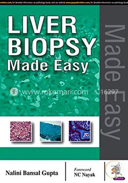 Liver Biopsy Made Easy image