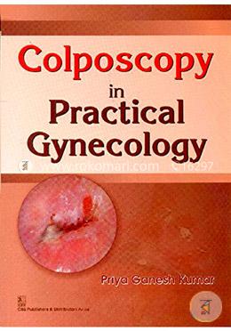 Colposcopy in Practical Gynecology image