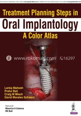 Treatment Planning Steps in Oral Implantology: A Color Atlas image