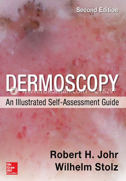 Dermoscopy: An Illustrated Self-Assessment Guide, 2nd Edition image