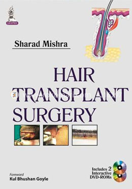 Hair Transplant Surgery image