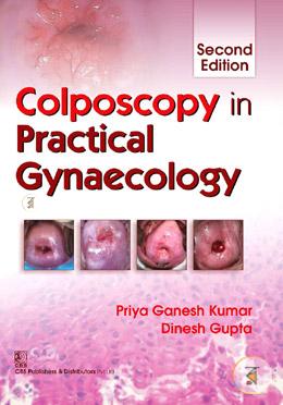 Colposcopy in Practical Gynecology image