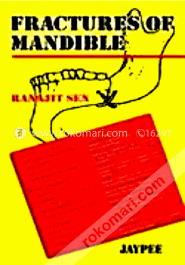 Fractures of Mandible (Paperback) image