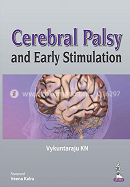 Cerebral Palsy and Early Stimulation image
