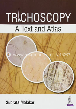 Trichoscopy: A Text and Atlas image