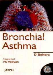 Bronchial Asthma image