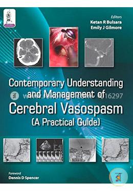 Contemporary Understanding and Management of Cerebral Vasospasm (A Practical Guide) image