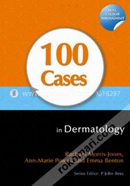 100 Cases in Dermatology (Paperback) 