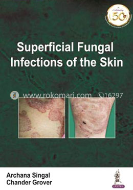Superficial Fungal Infections of the Skin image