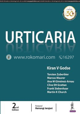 Urticaria image
