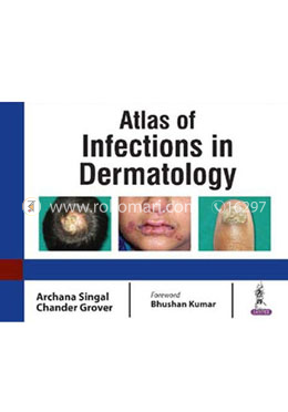 Atlas of Infections in Dermatology image