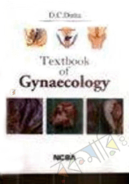 Textbook of Gynaecology image