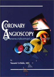 Coronary Angioscopy image