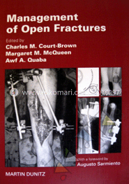Management of Open Fractures image