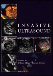 Invasive Ultrasound image