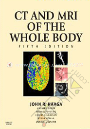 CT and MRI of the Whole Body (2-Volume Set) image