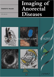 Imaging of Anorectal Diseases image