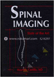 Spinal Imaging: State of the Art image