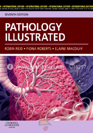 Pathology Illustrated image