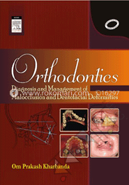 Orthodontics : Diagnosis And Management Of Malocclusion And Detofacial Deformities image