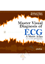 Mastering Visual Diagnosis of ECG image
