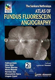 Atlas of Fudus Fluorescein Angiography image