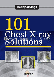101 Chest X-Ray Solutions image