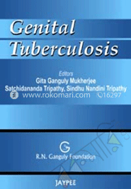 Genital Tuberculosis image