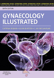 Gynaecology Illustrated image