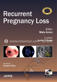 Recurrent Pregnancy Loss (with Audio Visual CD Rom) image