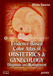 Evidence Based Color Atlas of Obstetrics and Gynecology: Diagnosis and Management image