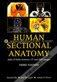 Human Sectional Anatomy Atlas of Body Sections, CT and MRI Images (Paperback) image