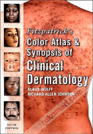Fitzpatrick's Color Atlas and Synopsis of Clinical Dermatology (Paperback)  image