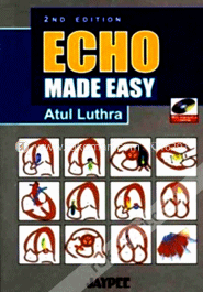 ECHO Made Easy (Paperback) image