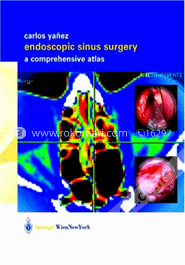 Endoscopic Sinus Surgery: A Comprehensive Atlas image