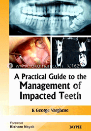 A Practical Guide to the Management of Impacted Teeth image