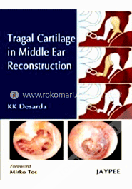 Tragal Cartilage in Middle Ear Reconstruction image