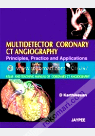 Multidetector Coronary CT Angiography image