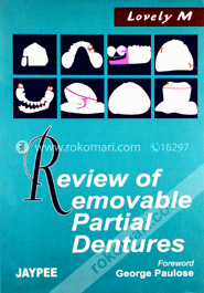 Review of Removable Partial Dentures (Paperback) image