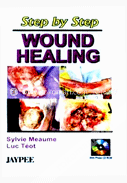 Step by Step Wound Healing (with CD Rom) (Paperback) image