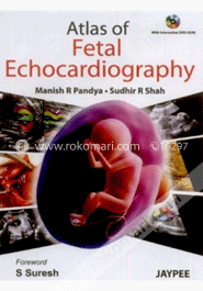 Atlas of Fetal Echocardiography image