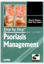 Psoriasis Management (Step By Step) (Paperback) image