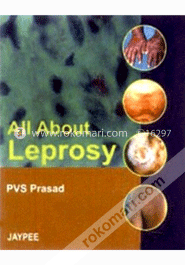 All About Leprosy 