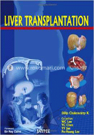 Liver Transplantation image