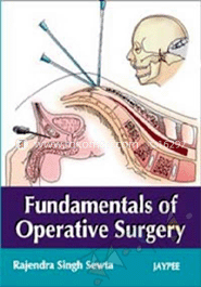 Fundamentals Of Operative Surgery image
