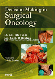 Decision Making In Surgical Oncology image