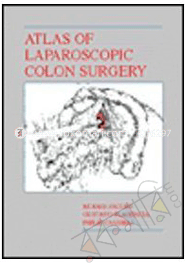 Atlas of Laparoscopic Colon Surgery image