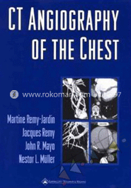CT Angiography of the Chest (Hardcover) image