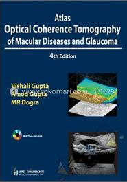 Atlas Optical Coherence Tomography of Macular Diseases and Glaucoma image