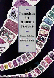 Parasites in Human Tissues 